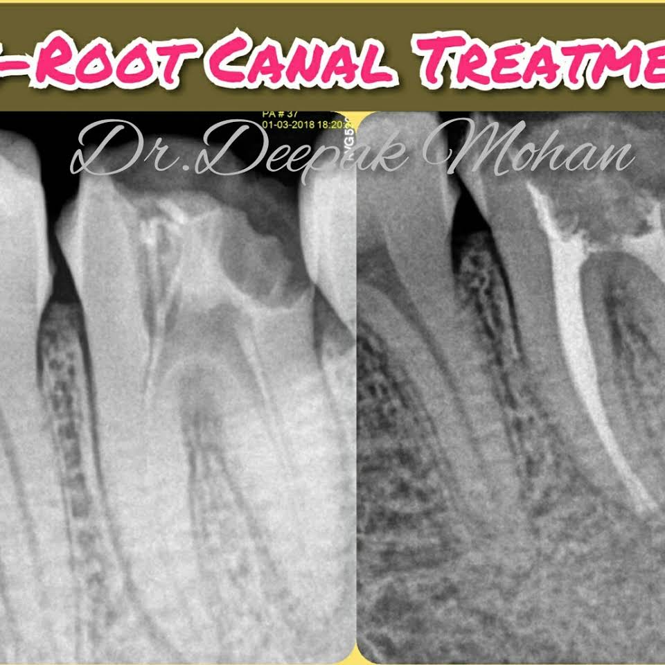 Suraksha Speciality Dental Care - Dr Deepak Mohan